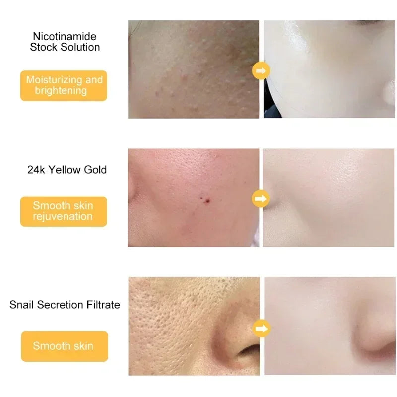 24K Gold Face Serum Hyaluronic Acid Acne Serum Moisturizer Essence Cream Whitening Day Creams Anti Aging Anti Wrinkle Skin Care